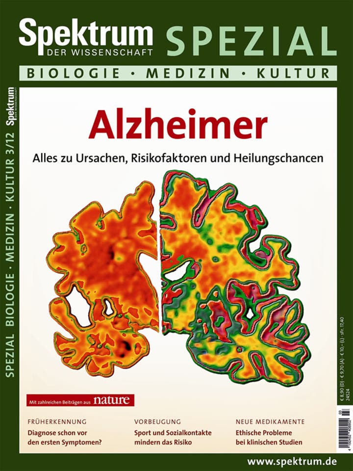 Spektrum der Wissenschaft Spezial Biologie - Medizin - Hirnforschung - 3/2012 - Alzheimer