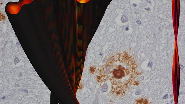 Querschnitt einer Alzheimer-Amyloidfibrille