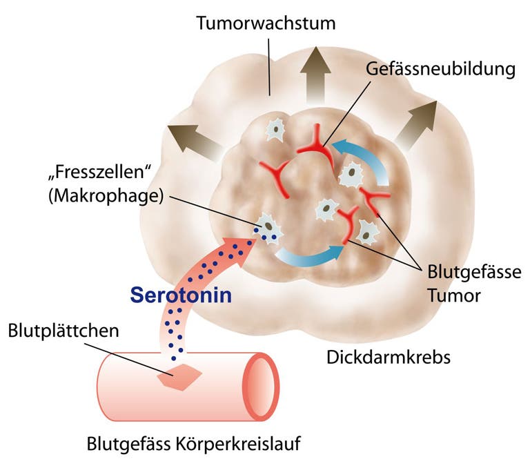 Dickdarmkrebs: Die Wirkung von Serotonin