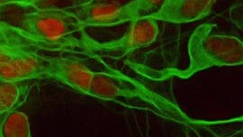 Motoneurone aus individuellen ip-Stammzellen