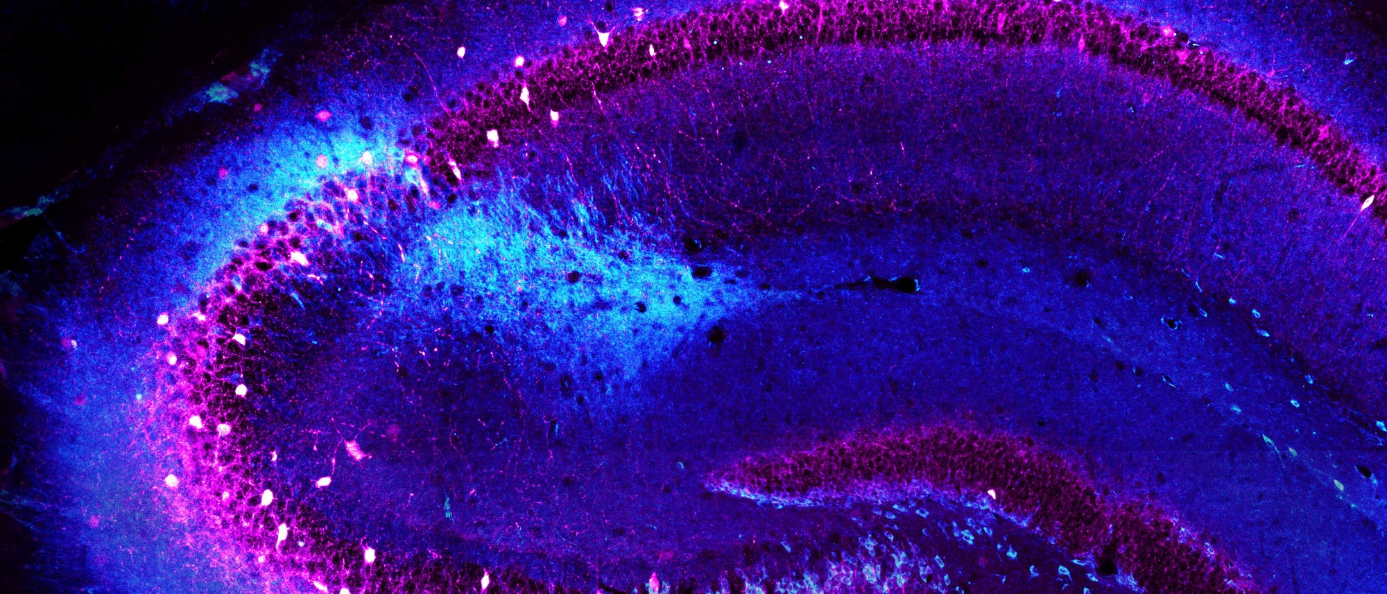 CA2-Region des Mäuse-Hippocampus CA2-Region des Mäuse-Hippocampus