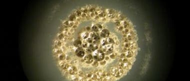 Daptomycin-resistente Bodenbakterien Daptomycin-resistente Bodenbakterien