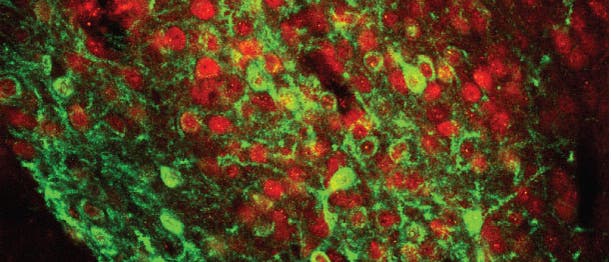 Furcht-Neurone in den zentralen Mandelkernen einer Maus Furcht-Neurone in den zentralen Mandelkernen einer Maus