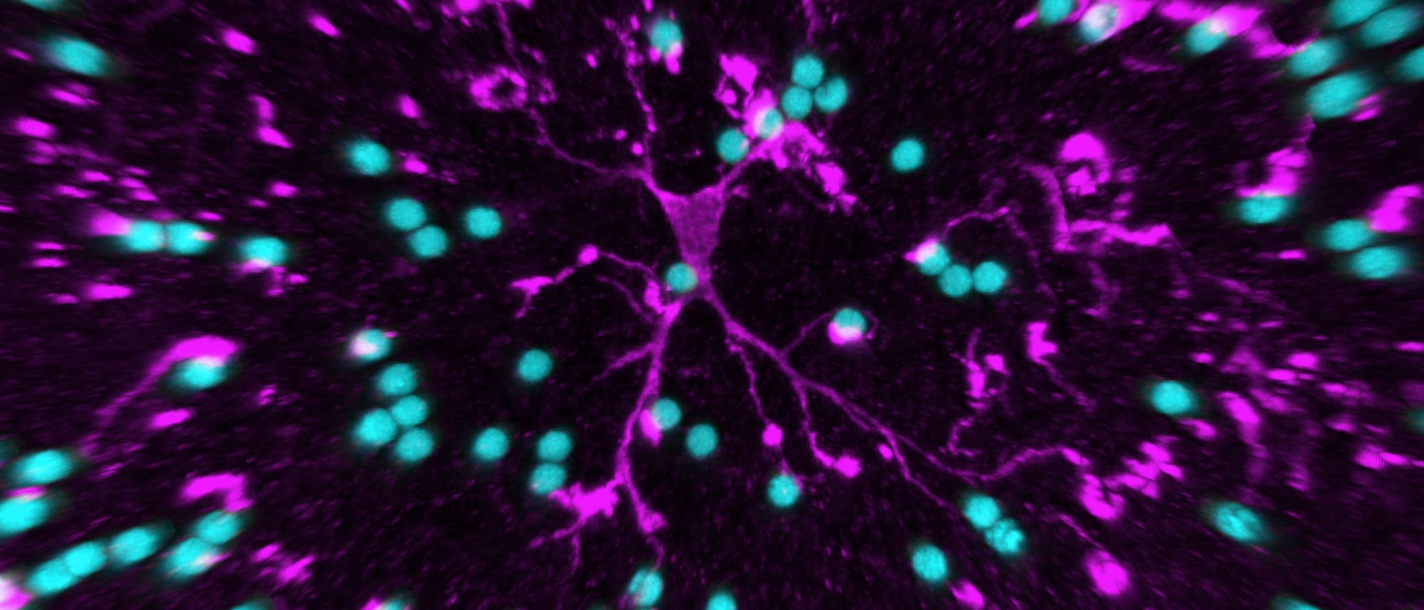 Mikroglia Mikroglia