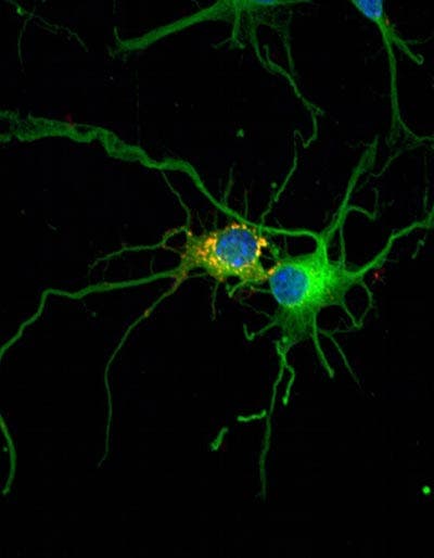 Glykogen in Neuronen