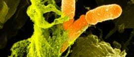 Gefangenes Bakterium Gefangenes Bakterium