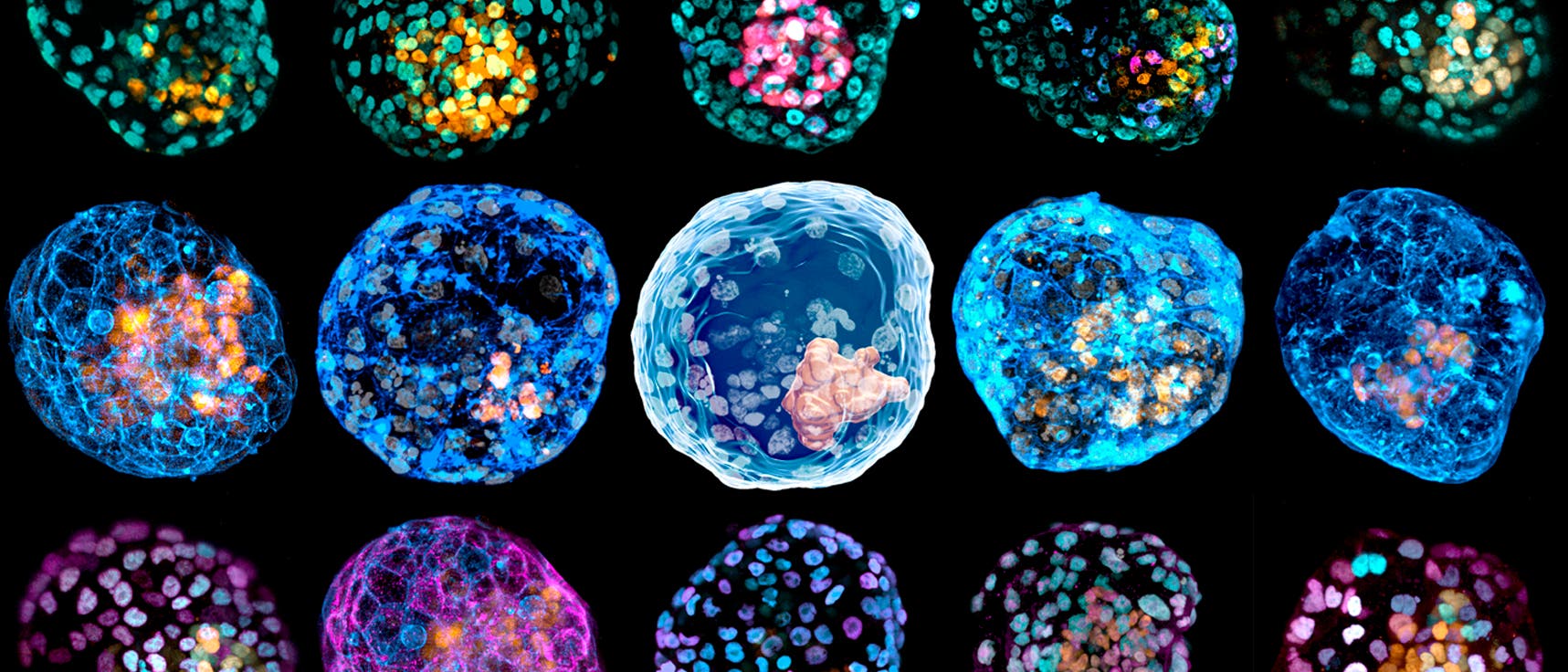 Blastoide sind das Vorläuferstadium der Gastrulation Blastoide sind das Vorläuferstadium der Gastrulation