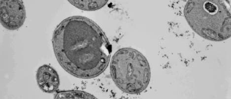 Wangiella dermatitidis Wangiella dermatitidis