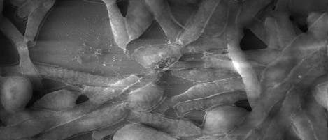 Biofilm von <i>Candida albicans</i> Biofilm von <i>Candida albicans</i>