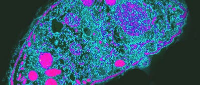 Toxoplasma gondii in Nahaufnahme Toxoplasma gondii in Nahaufnahme