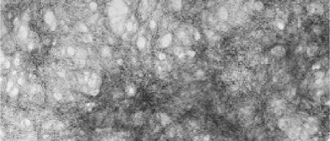 Amyloid-Fasern Amyloid-Fasern