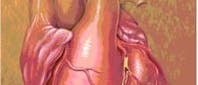 Xenotransplantation Xenotransplantation