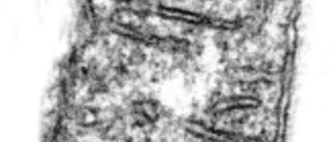Mitochondrium Mitochondrium