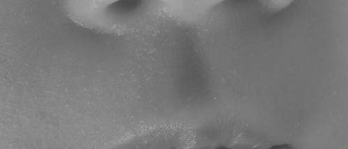 Nase Nase