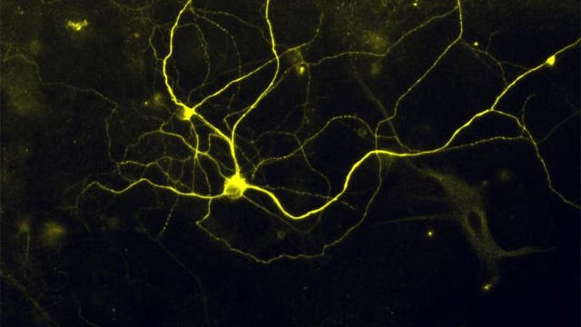 Induzierte sensorische Neurone