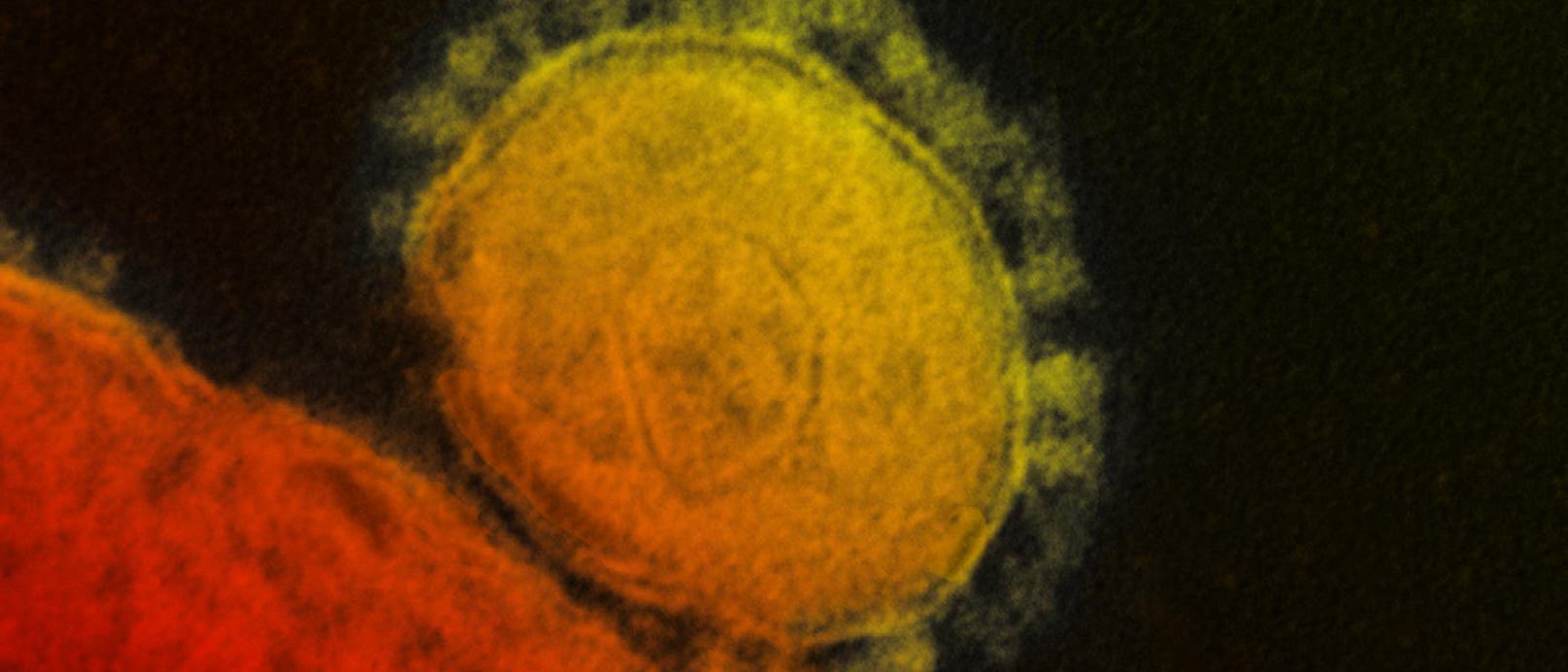 Mers-Virus bei der Attacke Mers-Virus bei der Attacke