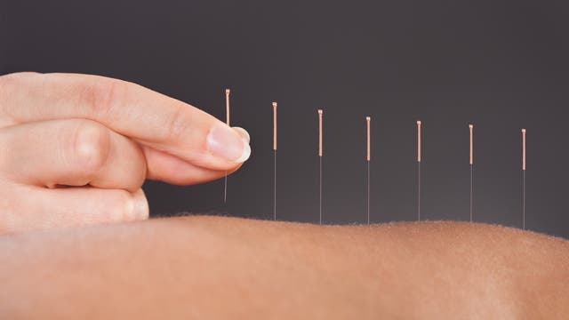 Vorsicht: Vorsicht, nur weil man meint, die Akupunktur habe geholfen, muss sie noch lange nicht wirksam sein.