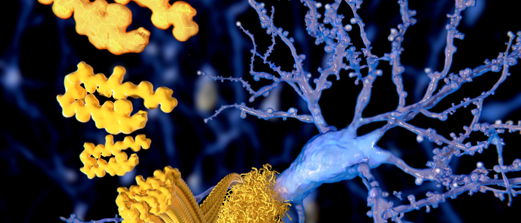 Alzheimer Beta-Amyloid Alzheimer Beta-Amyloid
