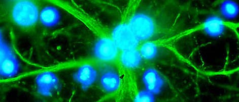 Ein Netz von Astrozyten Ein Netz von Astrozyten