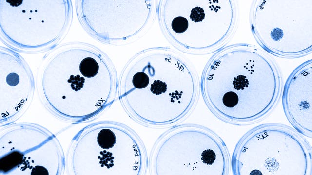 Petrischalen mit Bakterien