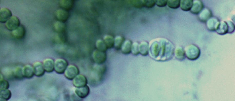 Cyanobakterien der Gattung Nostoc Cyanobakterien der Gattung Nostoc