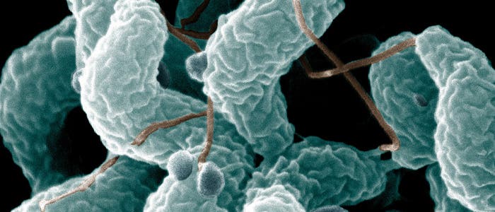 <i>Campylobacter jejuni</i> <i>Campylobacter jejuni</i>