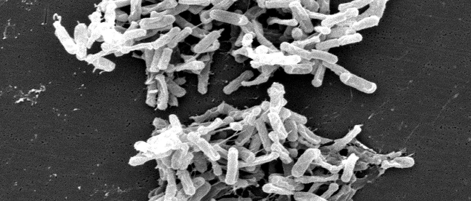 Elektronenmikroskopische Aufname von Clostridium difficilie Elektronenmikroskopische Aufname von Clostridium difficilie
