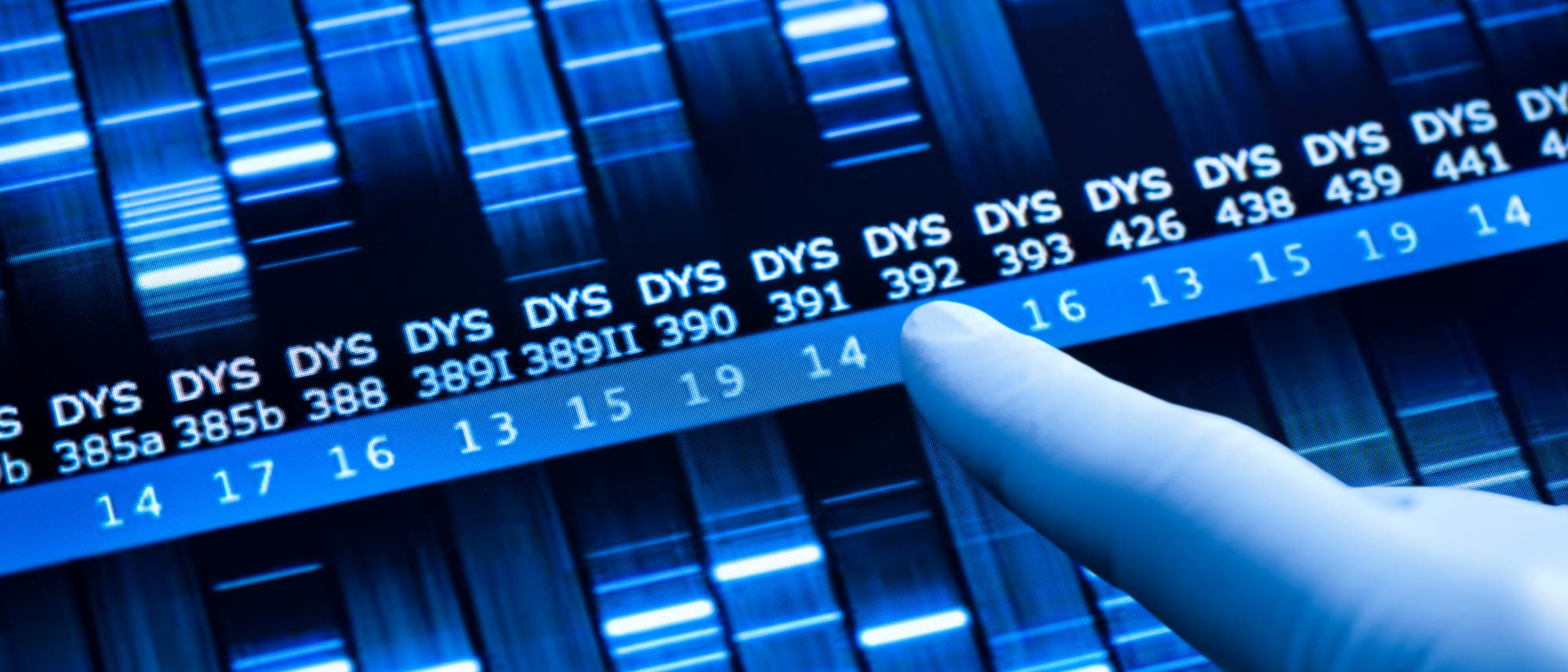 DNA-Analyse DNA-Analyse