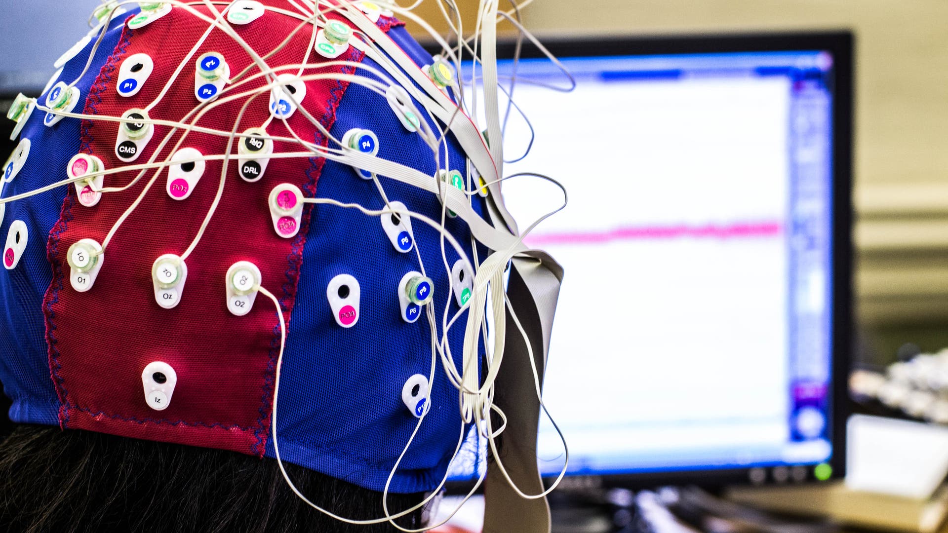 Depression EEG sagt Besserung voraus Spektrum