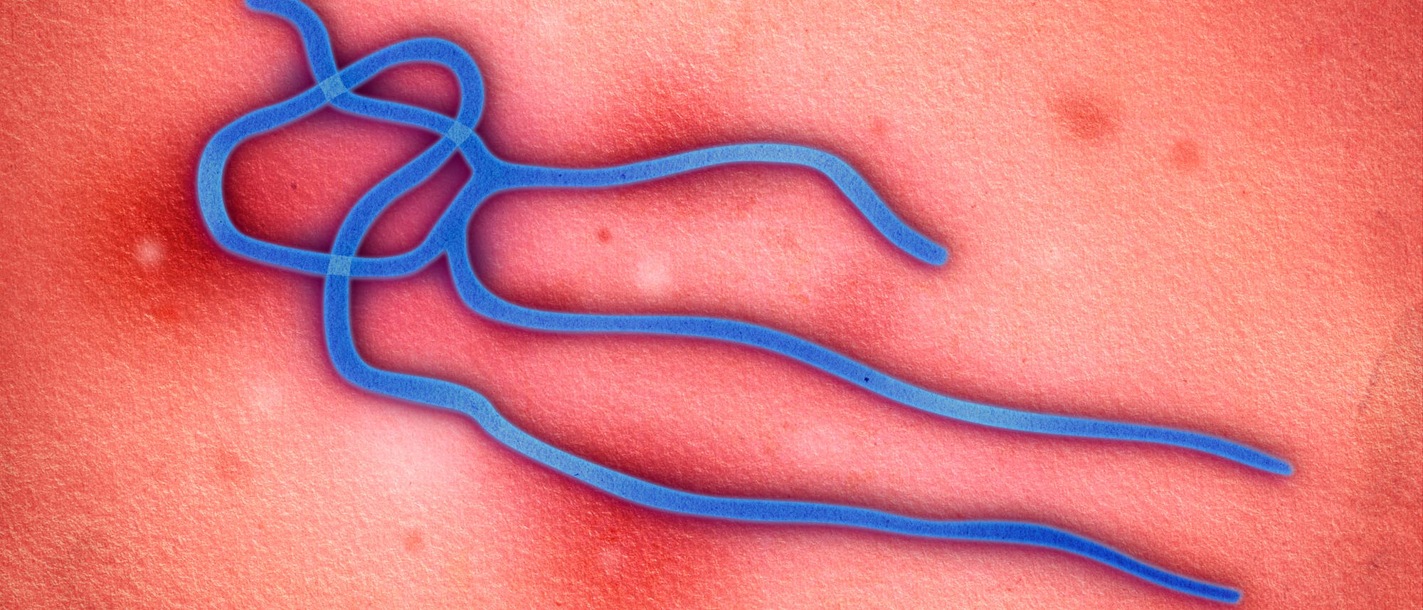 Ebola Ebola