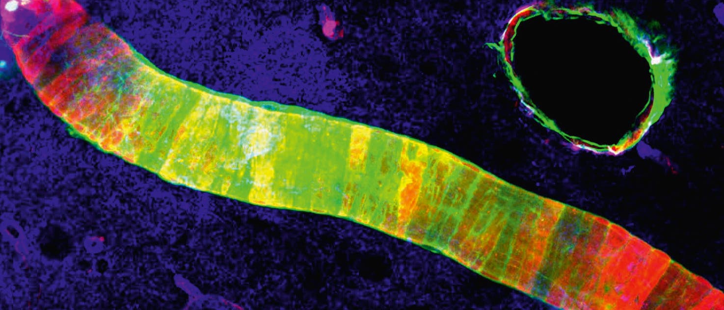 Das Kanalsystem um die Blutgefäße im Gehirn, genannt Glymphatisches System, lässt sich mit so genannten Tracer-Molekülen sichtbar machen. Das Kanalsystem um die Blutgefäße im Gehirn, genannt Glymphatisches System, lässt sich mit so genannten Tracer-Molekülen sichtbar machen.