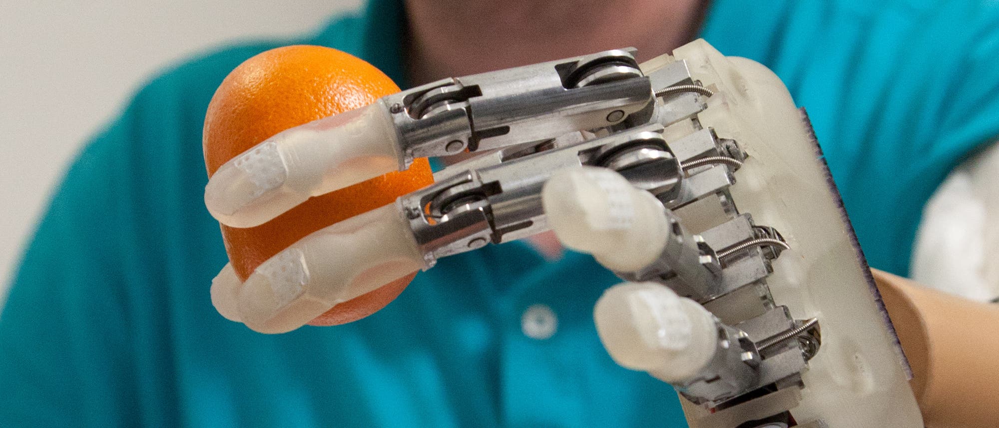 Handprothese mit viel Gefühl Handprothese mit viel Gefühl
