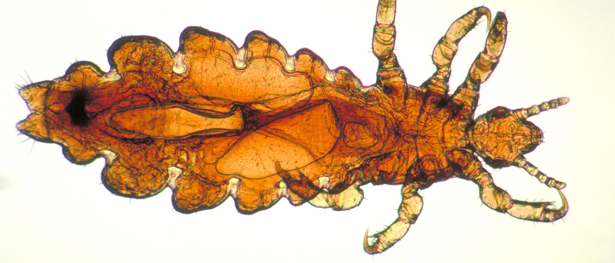 Kopflaus Kopflaus