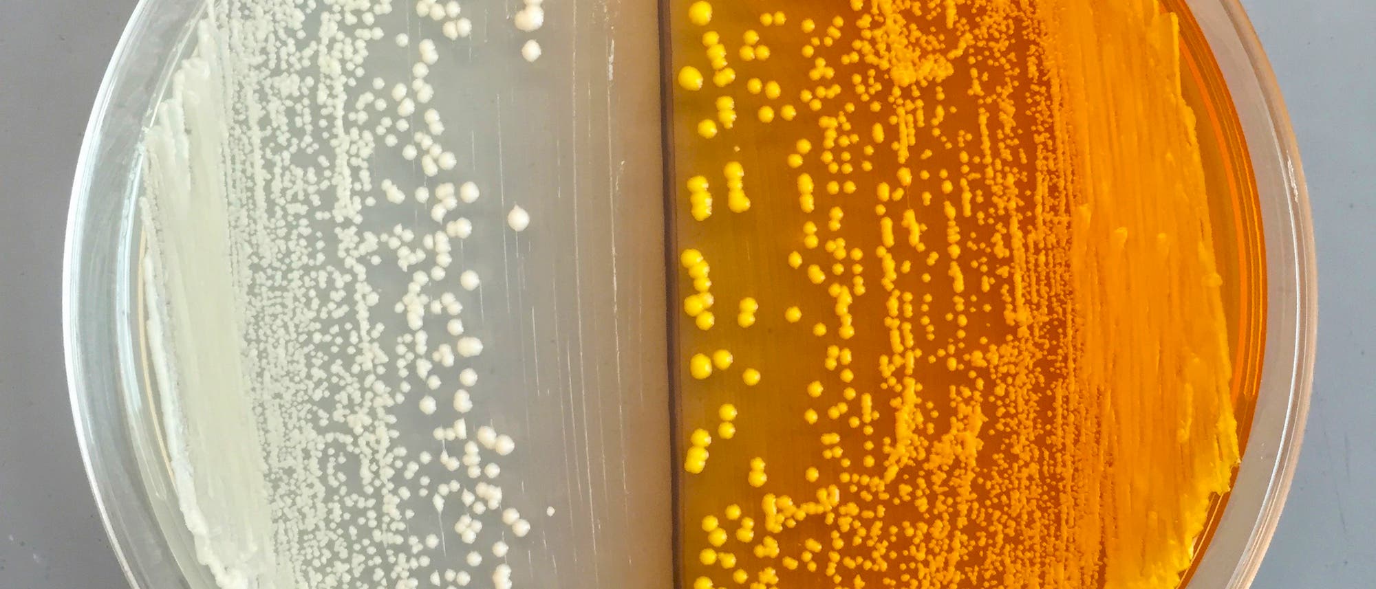 Hefe mit Spezialfähigkeiten Hefe mit Spezialfähigkeiten