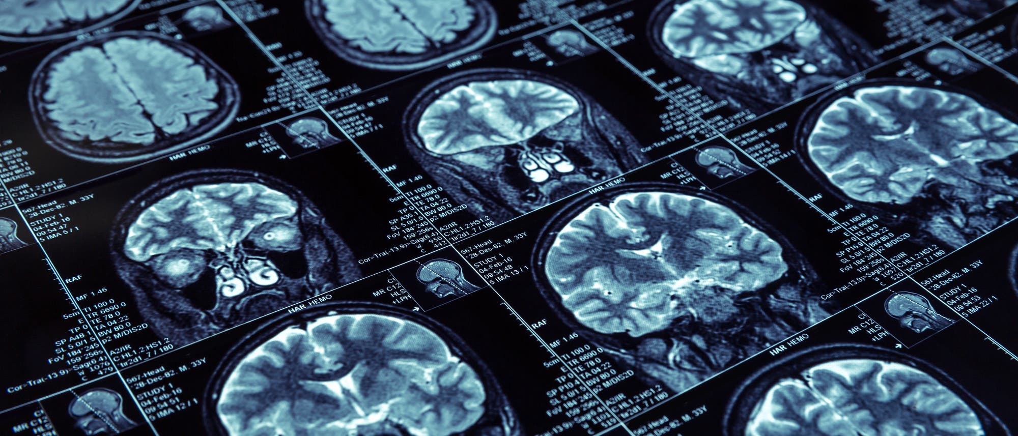 Hirnscans Hirnscans