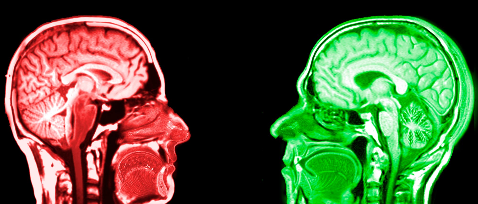 Emotionales versus rationales Hirn Emotionales versus rationales Hirn