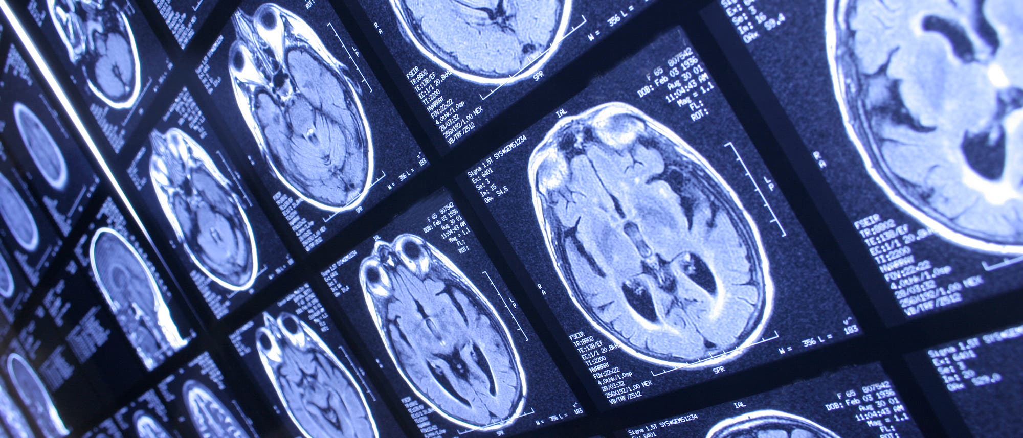 MRT-Hirnscans im Durchlicht MRT-Hirnscans im Durchlicht