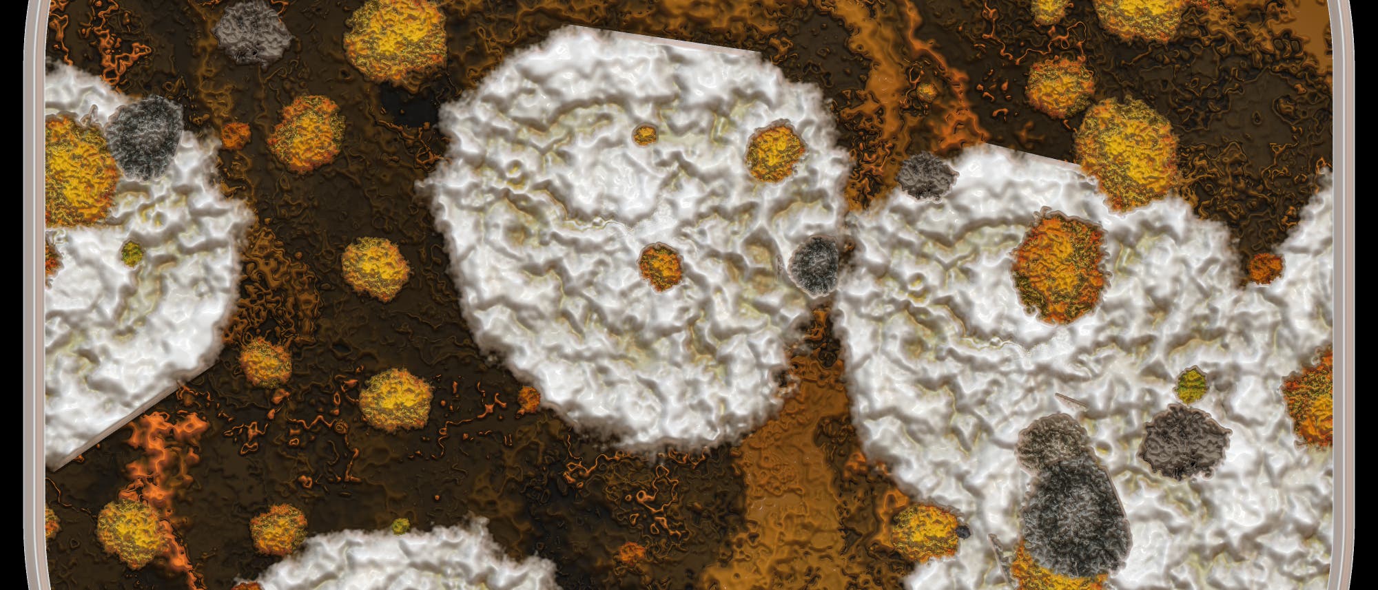 Der Pilz Histoplasma capsulatum kann Lungenkrankheiten auslösen Der Pilz Histoplasma capsulatum kann Lungenkrankheiten auslösen
