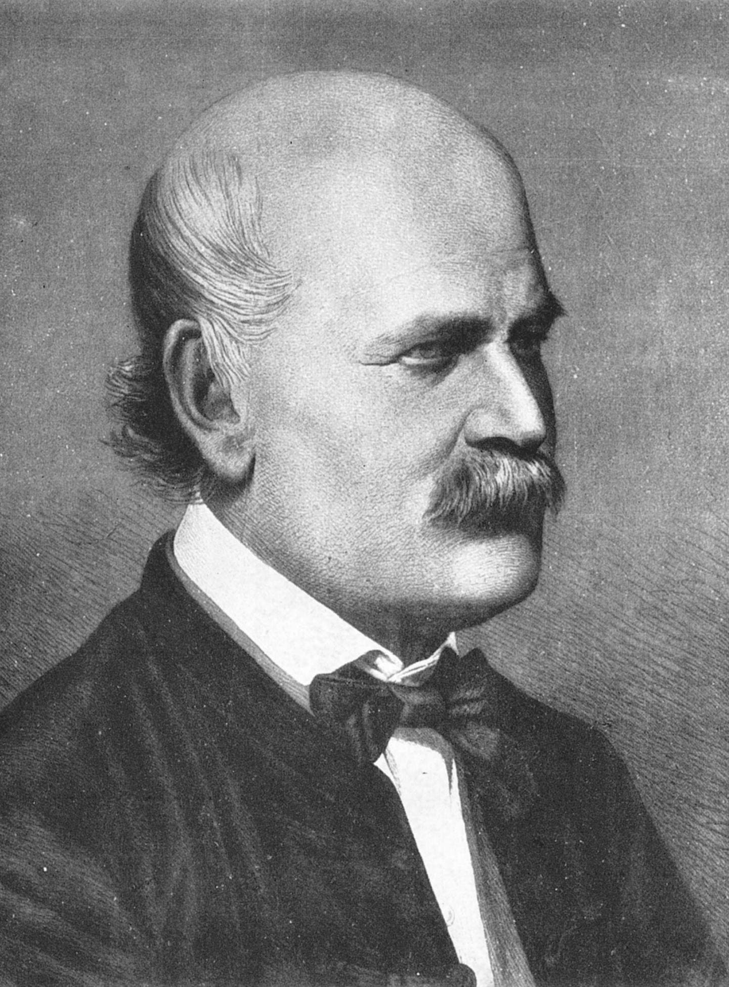 Semmelweis im Jahre 1860