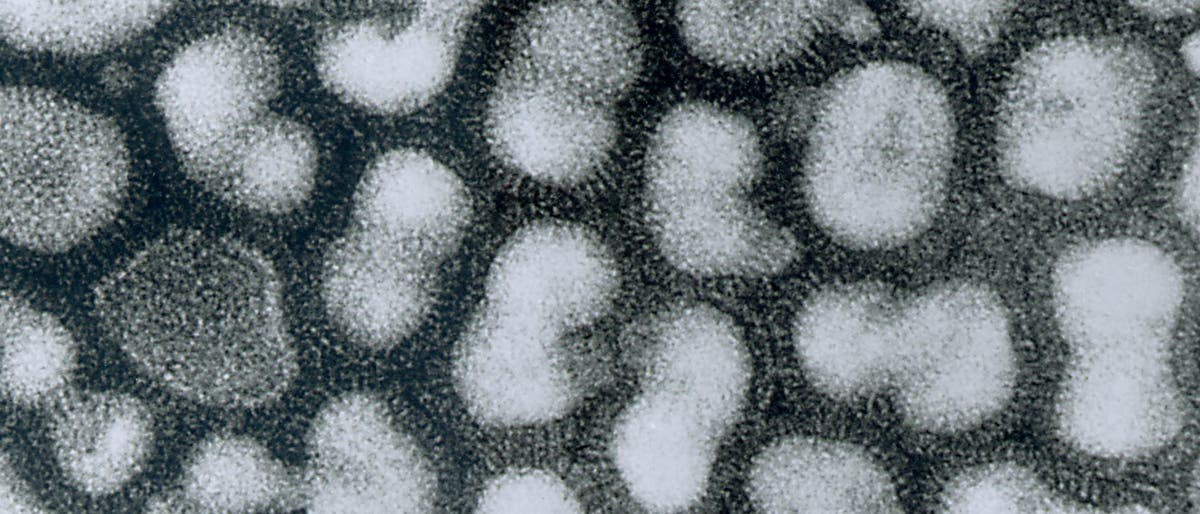 Vogelgrippe: H5N1-Viren Vogelgrippe: H5N1-Viren