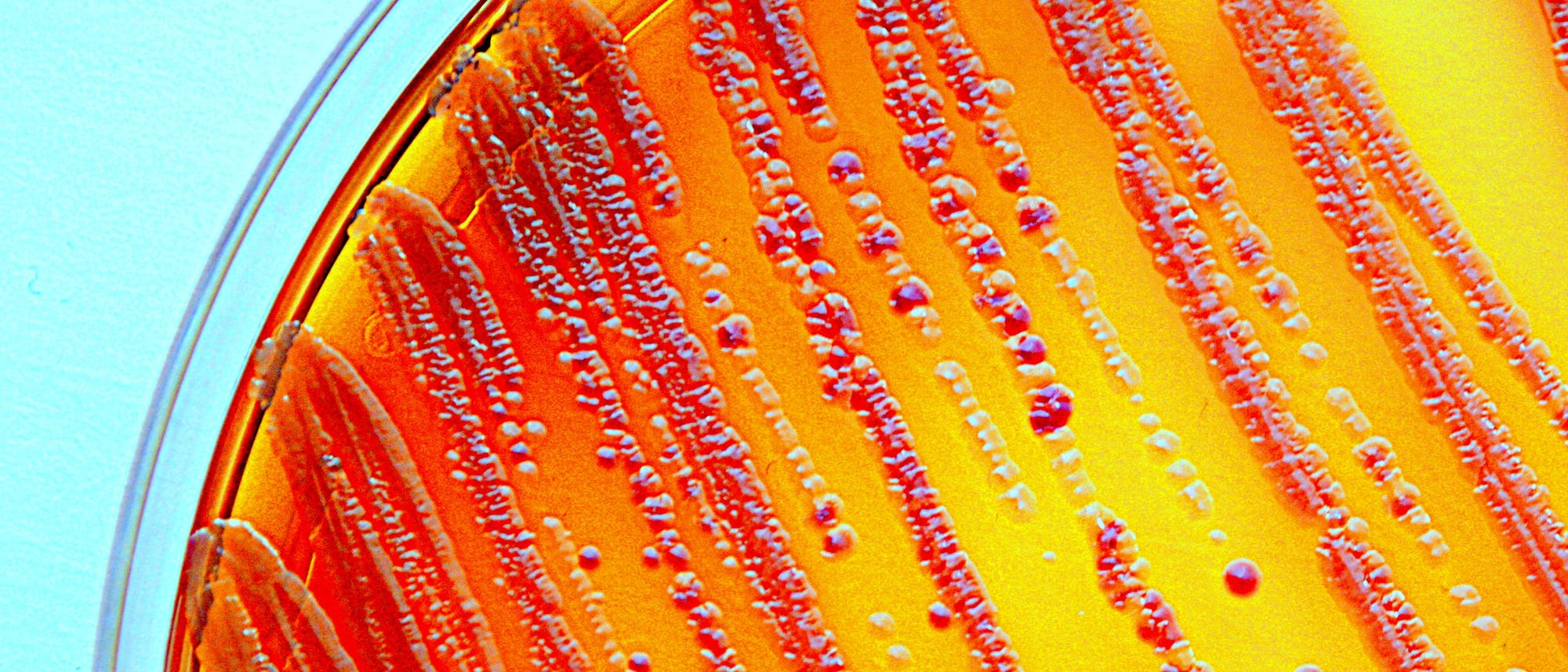 Escherichia coli wuchert in einer Petrischale Escherichia coli wuchert in einer Petrischale