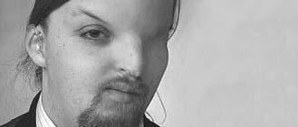 Lars Fischer Lars Fischer