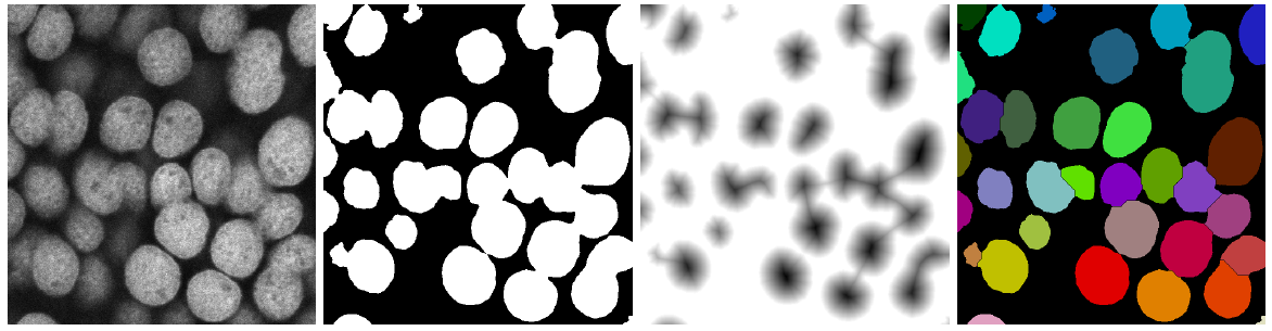 Mikroskopbilder von Zellkernen, erstellt mit dem Programm ImageJ