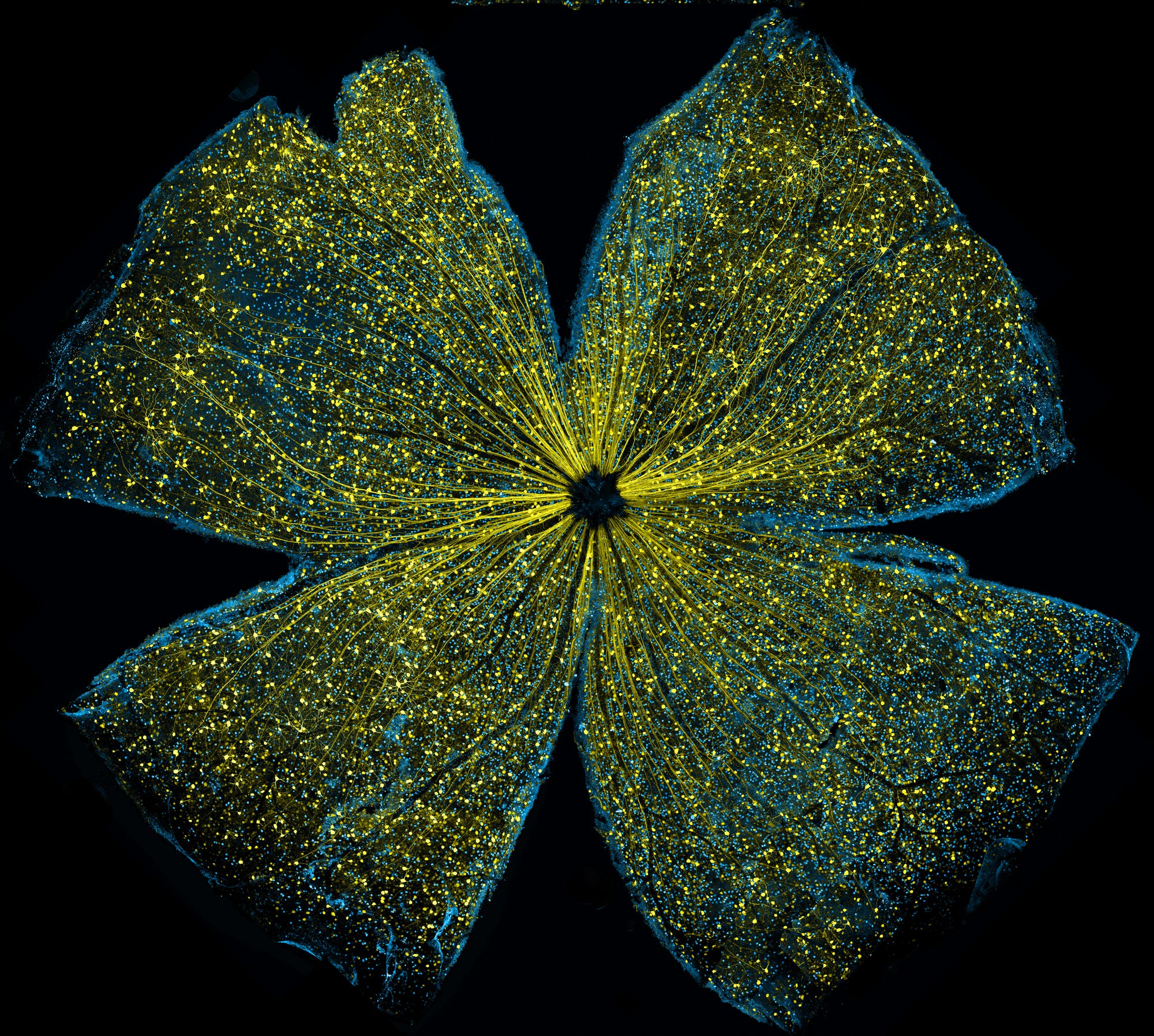 Fluoreszierende Netzhaut einer Maus Fluoreszierende Netzhaut einer Maus