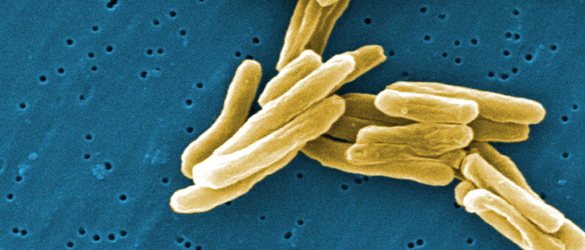 Tuberkulose-Bakterien Tuberkulose-Bakterien