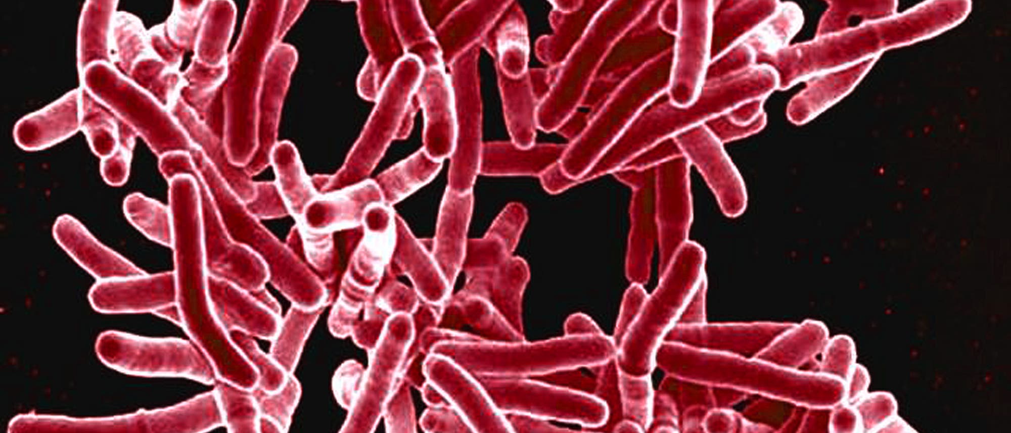Mycobacterium tuberculosis Mycobacterium tuberculosis