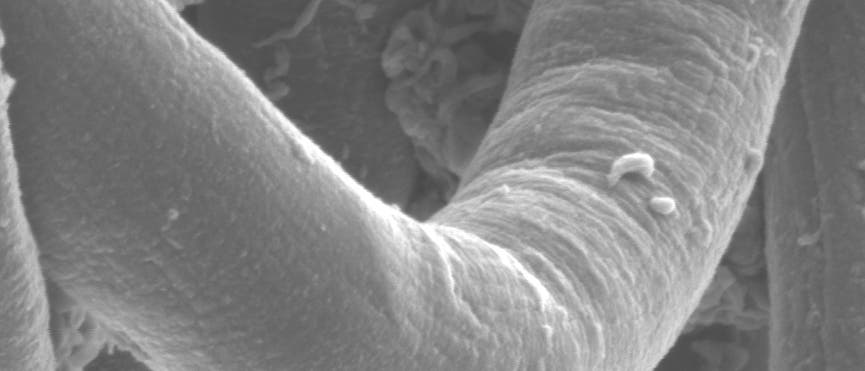 Seidennanofaser Seidennanofaser