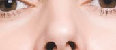 Nase Nase