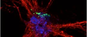 Neuron mit Exosomen und Endosomen Neuron mit Exosomen und Endosomen