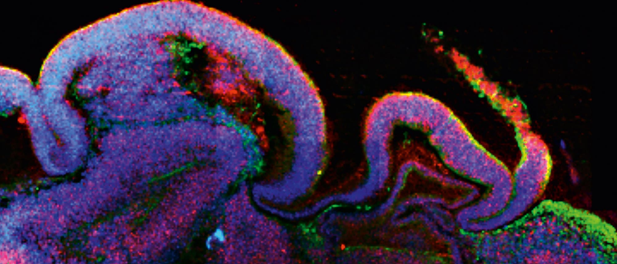 Gezüchtetes Organoid Gezüchtetes Organoid